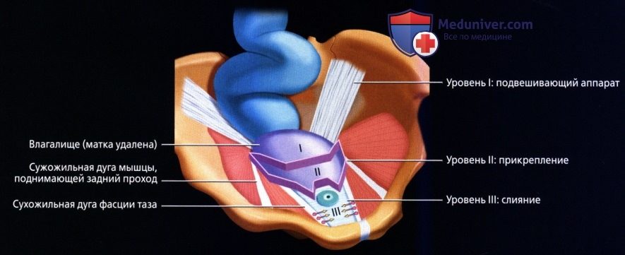 luchevaia_anatomia_tazovogo_dna_u_genchin-10-4852219