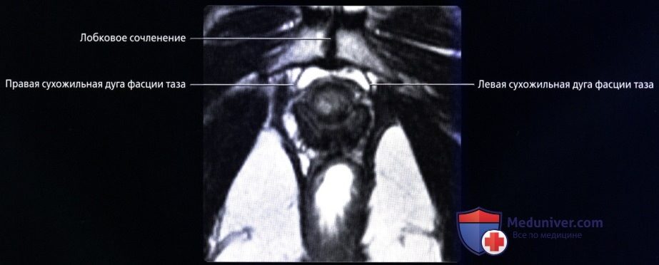 luchevaia_anatomia_tazovogo_dna_u_genchin-11-5831004