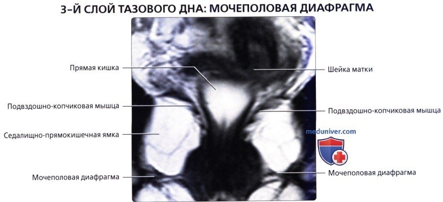 luchevaia_anatomia_tazovogo_dna_u_genchin-18-5694796