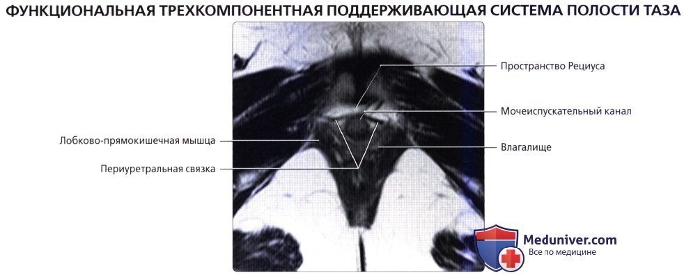 luchevaia_anatomia_tazovogo_dna_u_genchin-29-9305684