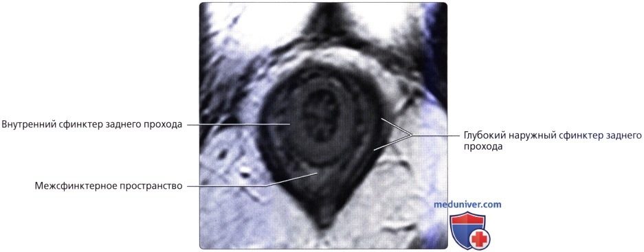 luchevaia_anatomia_tazovogo_dna_u_genchin-31-7371837