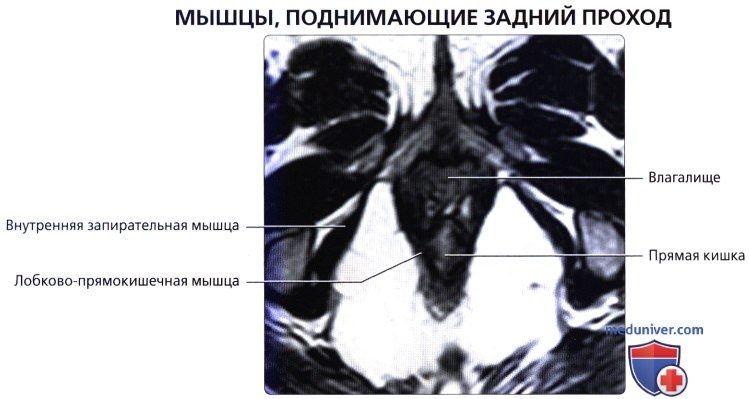 luchevaia_anatomia_tazovogo_dna_u_genchin-32-6762745