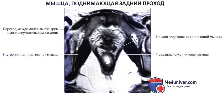 luchevaia_anatomia_tazovogo_dna_u_genchin-38-9495137