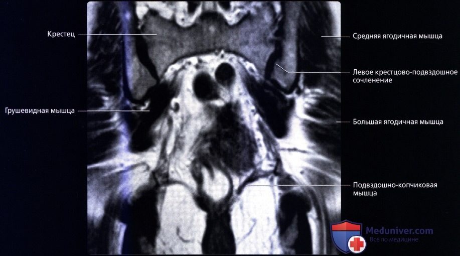 luchevaia_anatomia_tazovogo_dna_u_genchin-4-1902215
