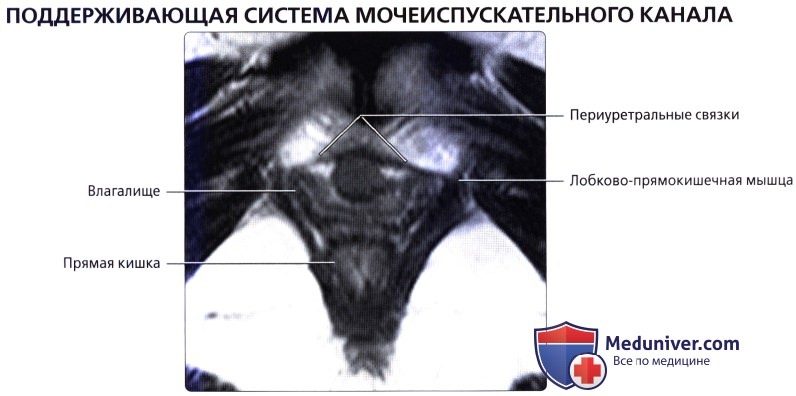 luchevaia_anatomia_tazovogo_dna_u_genchin-47-7042232