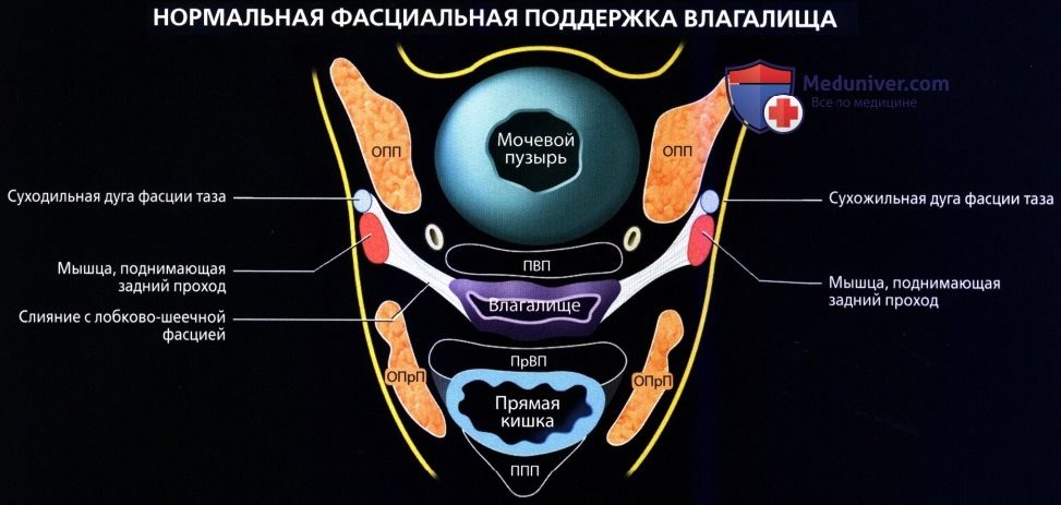 luchevaia_anatomia_tazovogo_dna_u_genchin-50-8477320