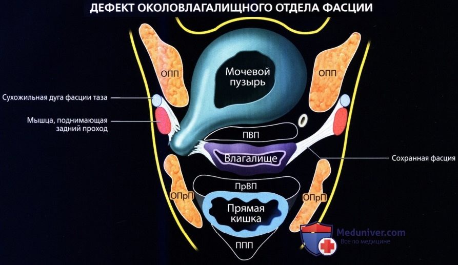 luchevaia_anatomia_tazovogo_dna_u_genchin-52-6459870