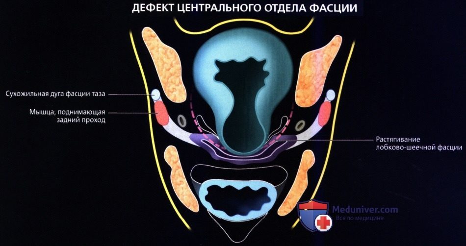 luchevaia_anatomia_tazovogo_dna_u_genchin-54-4694964