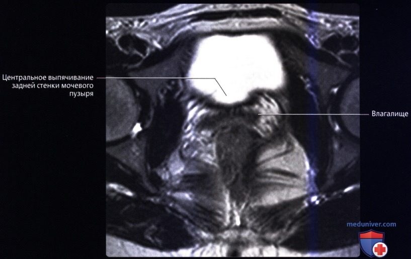 luchevaia_anatomia_tazovogo_dna_u_genchin-55-2680272