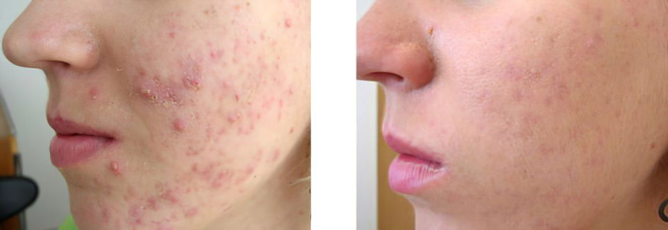 posle_lecheniey_prisheii546-4160939